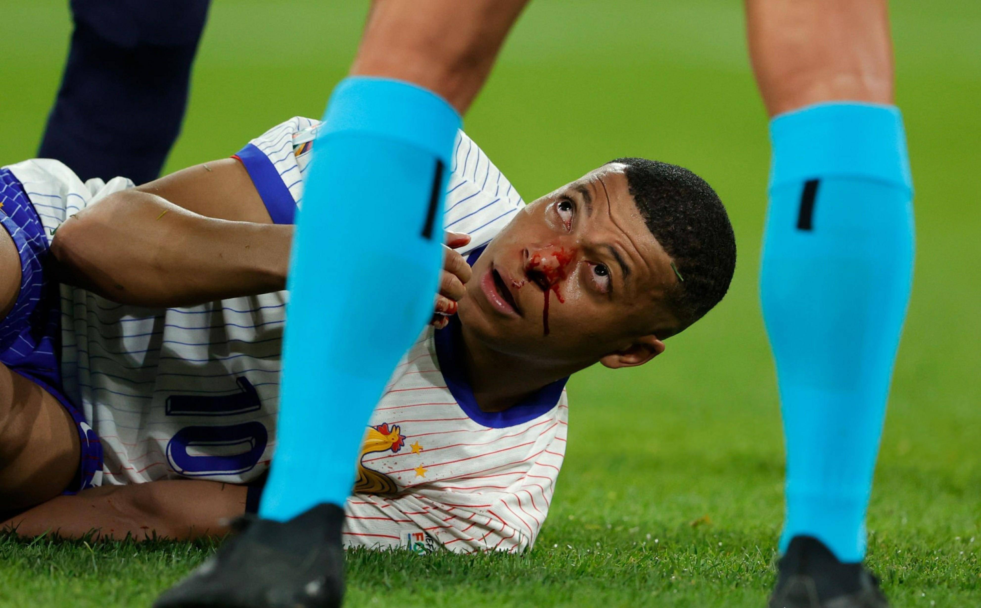 -欧洲杯预选赛中，法国队遭遇出乎意料的惨败